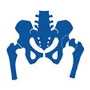 خلل التنسيج الوركي