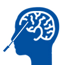 Endoscopic Brain Surgery