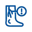 Varicose Vein Surgery