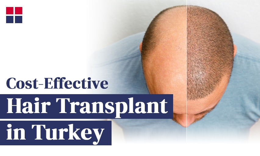 Why Are Hair Transplants So Cheap in Turkey?