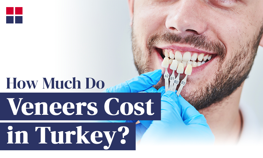 How Much Do Veneers Cost in Turkey?
