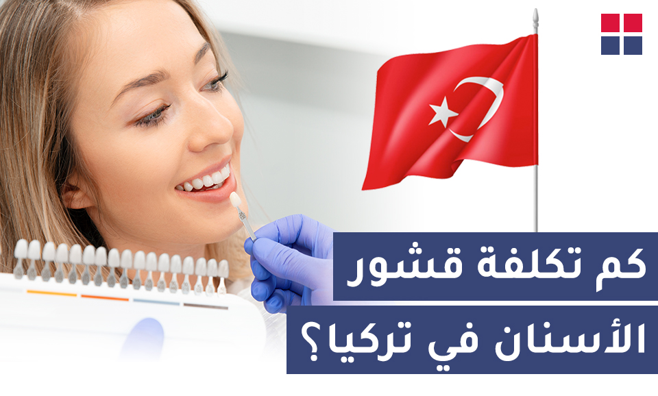 كم تكلفة قشور الأسنان في تركيا؟