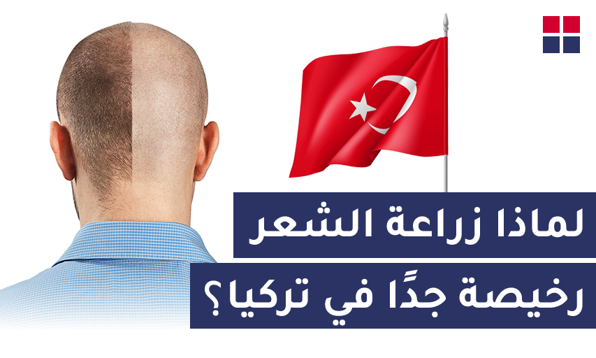 لماذا زراعة الشعر رخيصة جدًا في تركيا؟