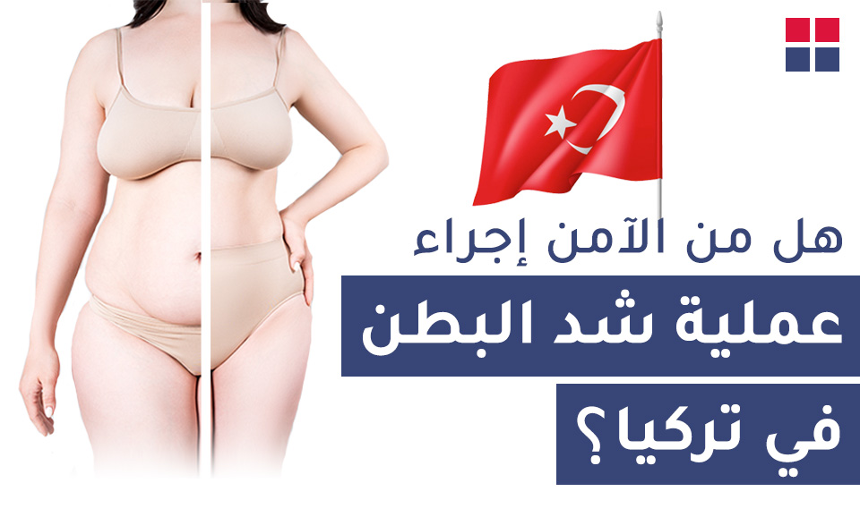 هل من الآمن إجراء عملية شد البطن في تركيا؟