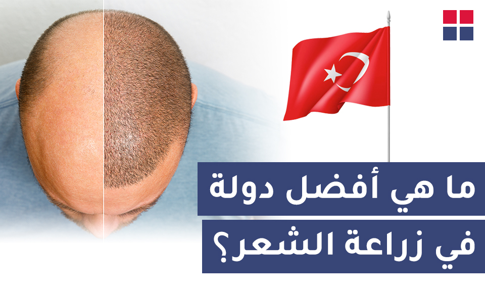 ما هي أفضل دولة في زراعة الشعر؟