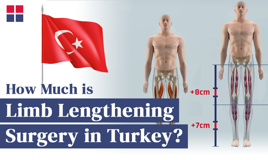How Much is Limb Lengthening Surgery in Turkey?