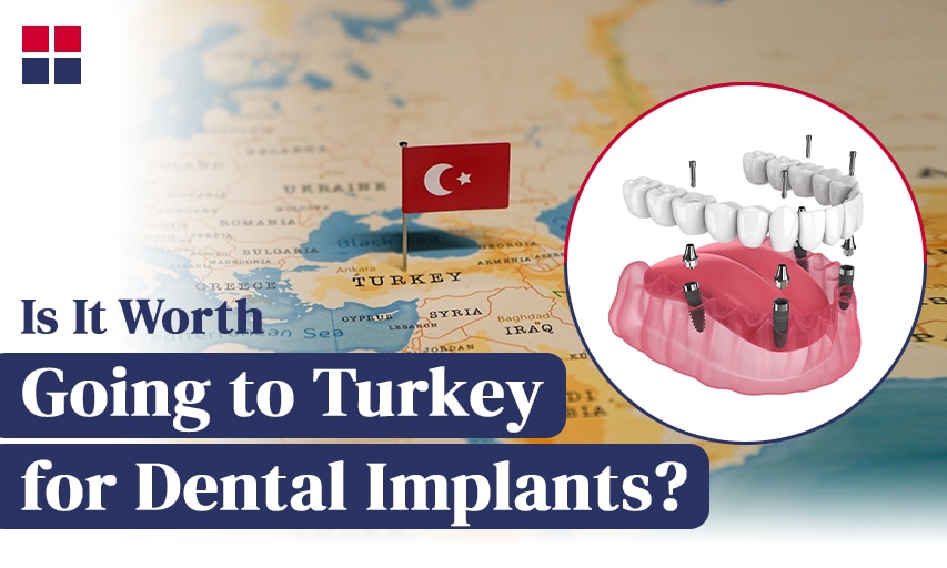 Is it Worth Going to Turkey for Dental Implants?