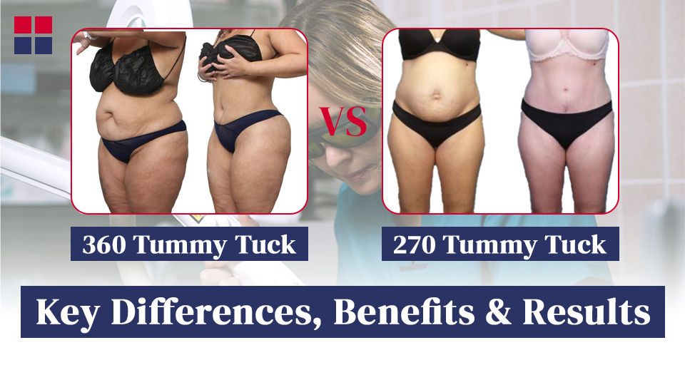 360 Tummy Tuck vs 270 Tummy Tuck: Key Differences, Benefits and Results