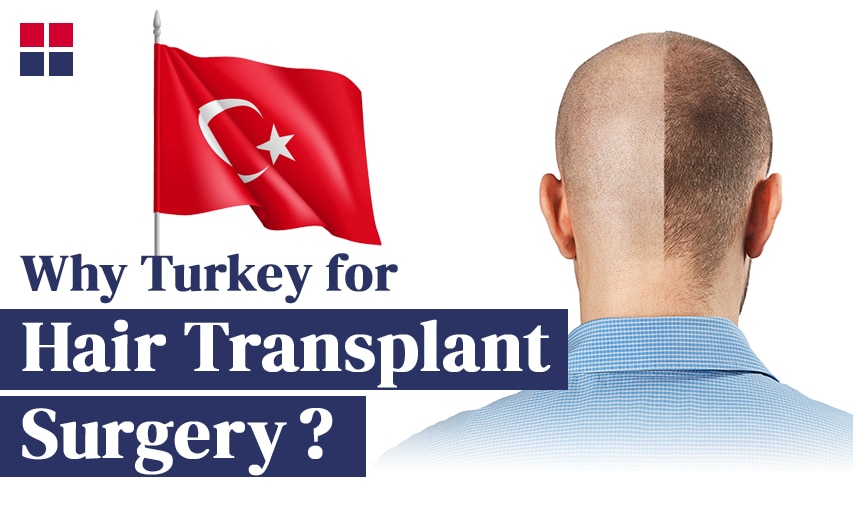 Why Do People Go to Turkey for Hair Transplant?