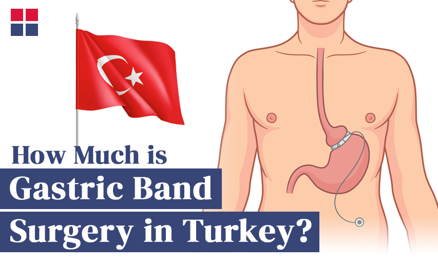 How Much is a Gastric Band in Turkey?