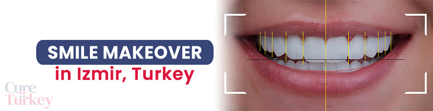 Smile Makeover - Izmir