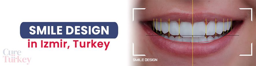 Smile Design - Izmir