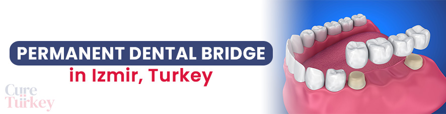 Dental Bridge in Izmir
