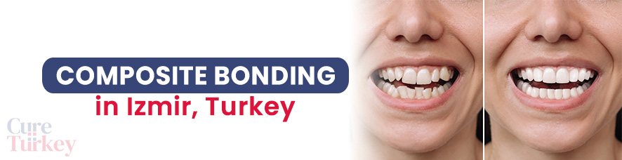 Composite Bonding in Izmir