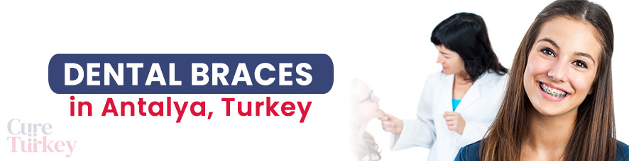 Dental Braces in Antalya