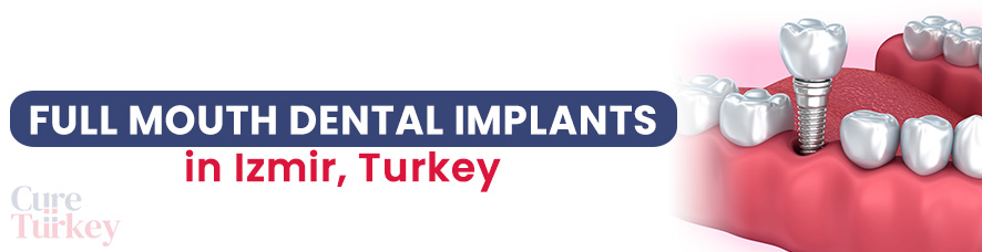 Full Mouth Dental Implants in Izmir