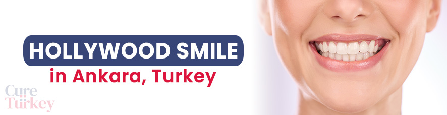 Hollywood Smile in Ankara