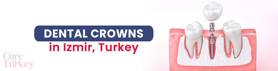 Dental Crowns in Izmir