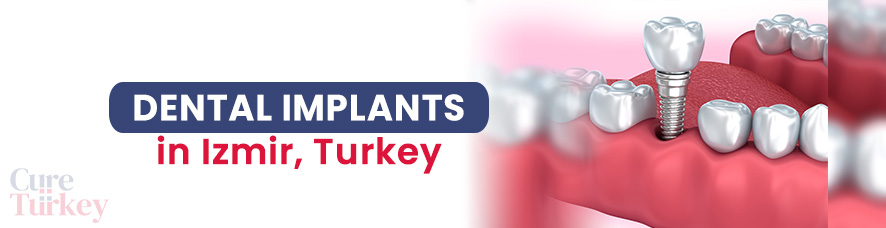 Dental Implants - Izmir