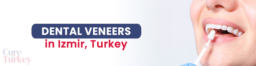Dental Veneers in Izmir
