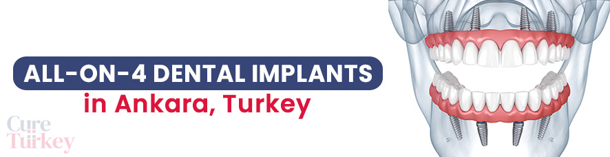 All on 4 Implants - Ankara
