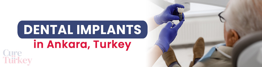 Full Mouth Dental Implants in Ankara