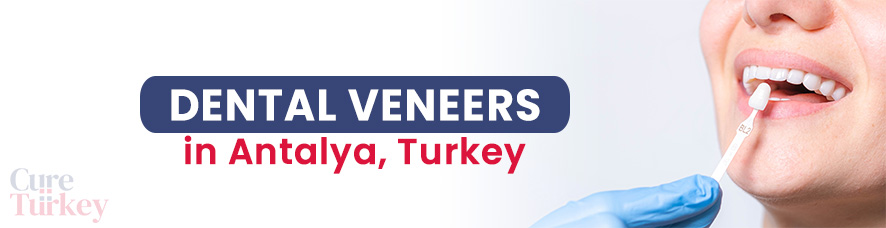 Dental Veneers in Antalya