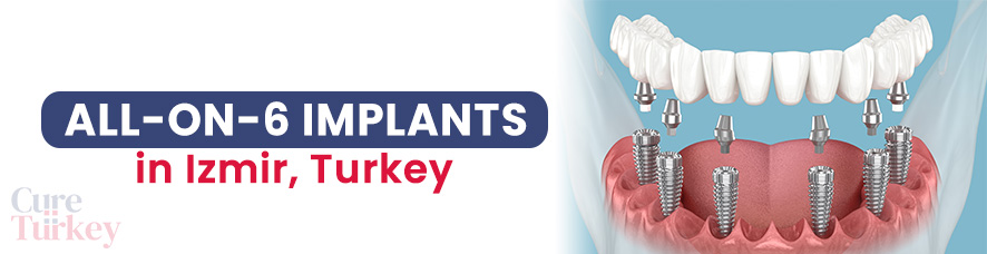 All-on-6 Implants - Izmir