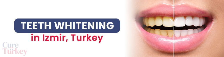 Teeth Whitening - Izmir
