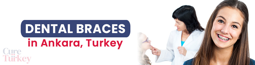 Dental Braces - Ankara