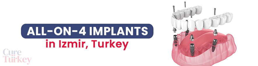 All-on-4 Implants - Izmir