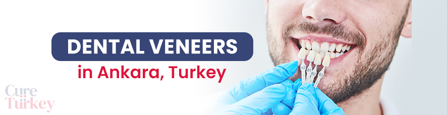 Dental Veneers in Ankara