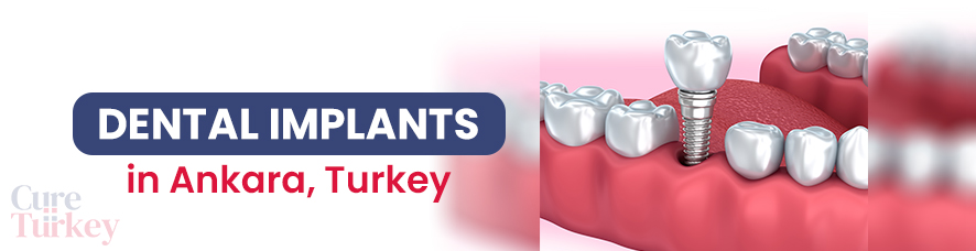 Dental Implants in Ankara