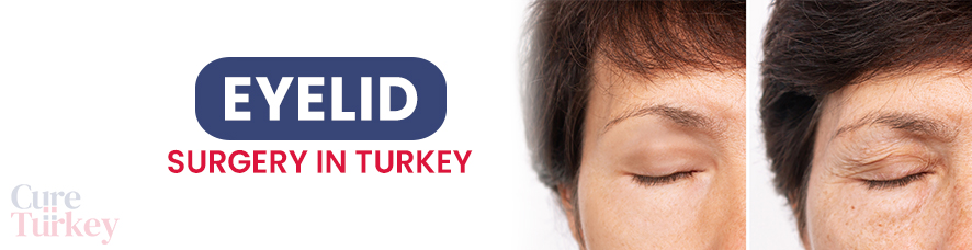 Eyelid Surgery