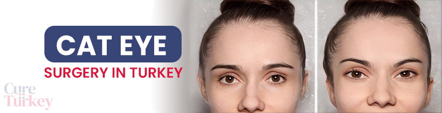 Cat Eye Surgery