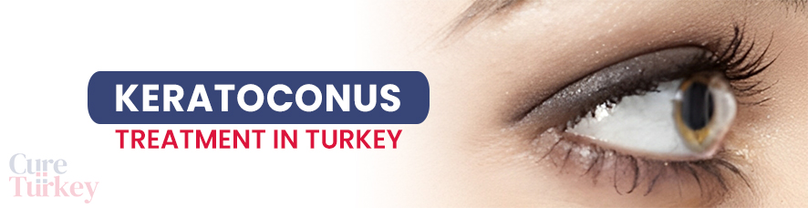 Keratoconus Treatment