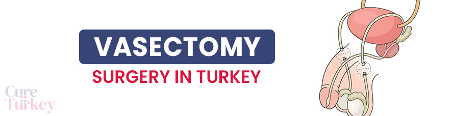 Vasectomy Surgery