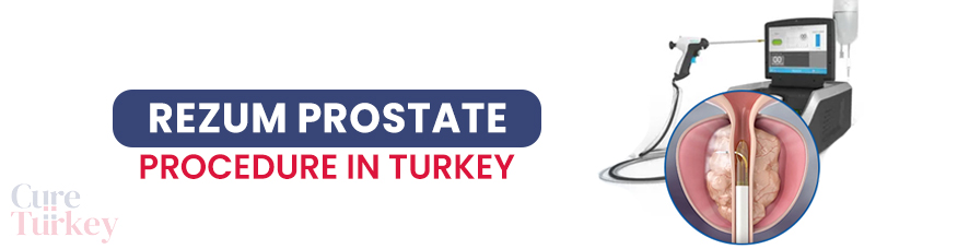 Rezum Prostate Procedure
