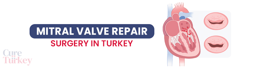 Mitral Valve Repair