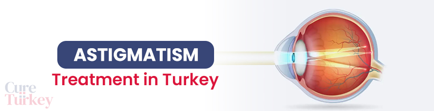 Astigmatism Treatment