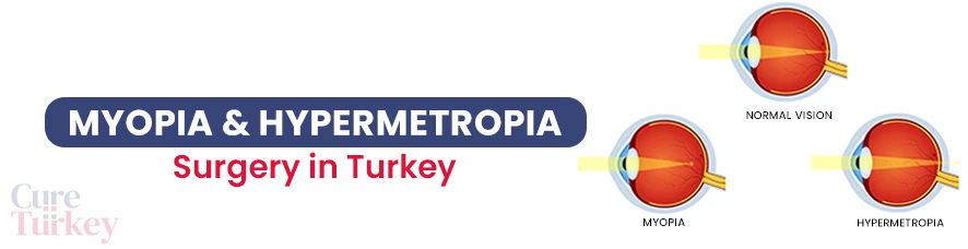 Myopia & Hypermetropia Treatment