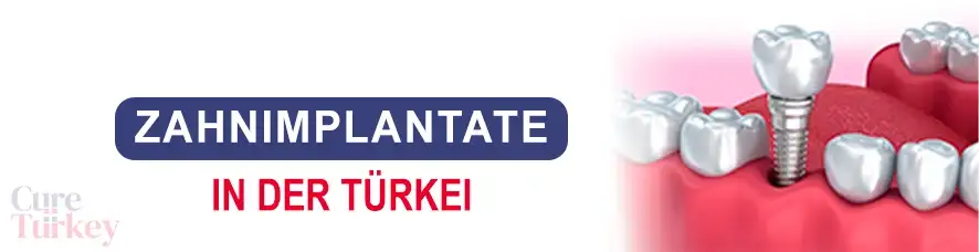 Zahnimplantate