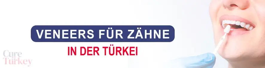 Veneers für Zähne