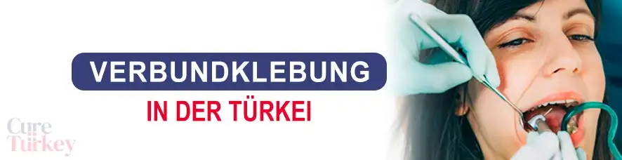 Verbundklebung