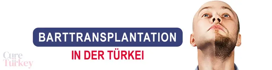 Barttransplantation