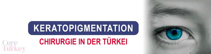 Keratopigmentation in der Türkei