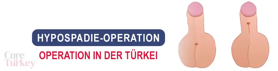 Hypospadie-Operation in der Türkei