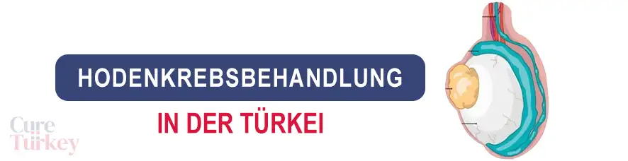 Hodenkrebsbehandlung in der Türkei