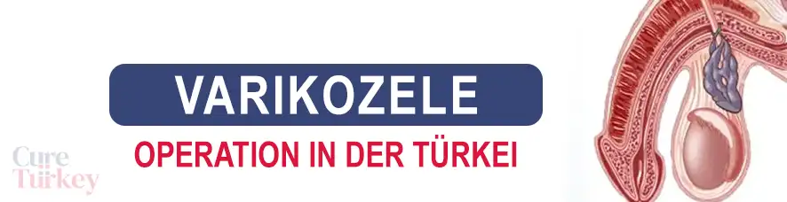 Varikozele Operation in der Türkei
