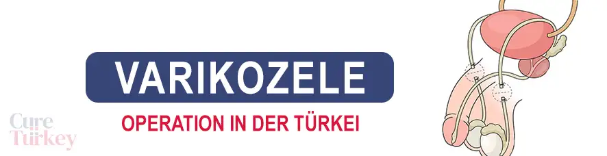 Vasektomie in der Türkei